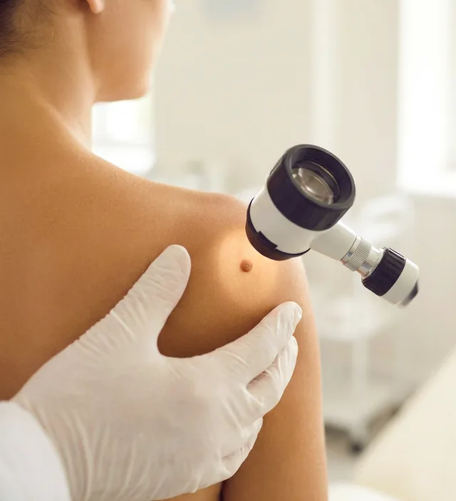 Hautchirurgie